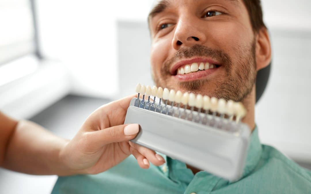 Types of Cosmetic Veneers