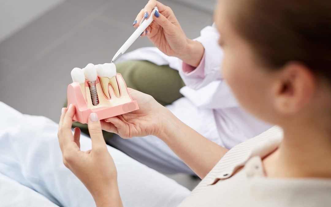 How Long Do Dental Implants Last?